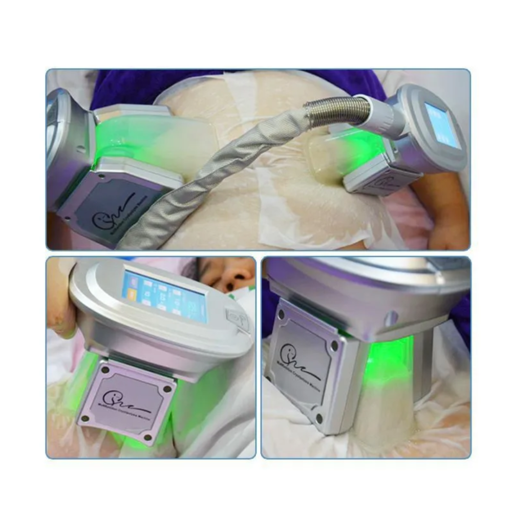 Membarana para Criolipolisis