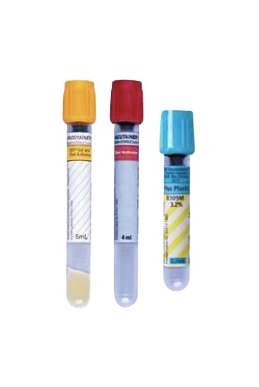 Tubos de plasma