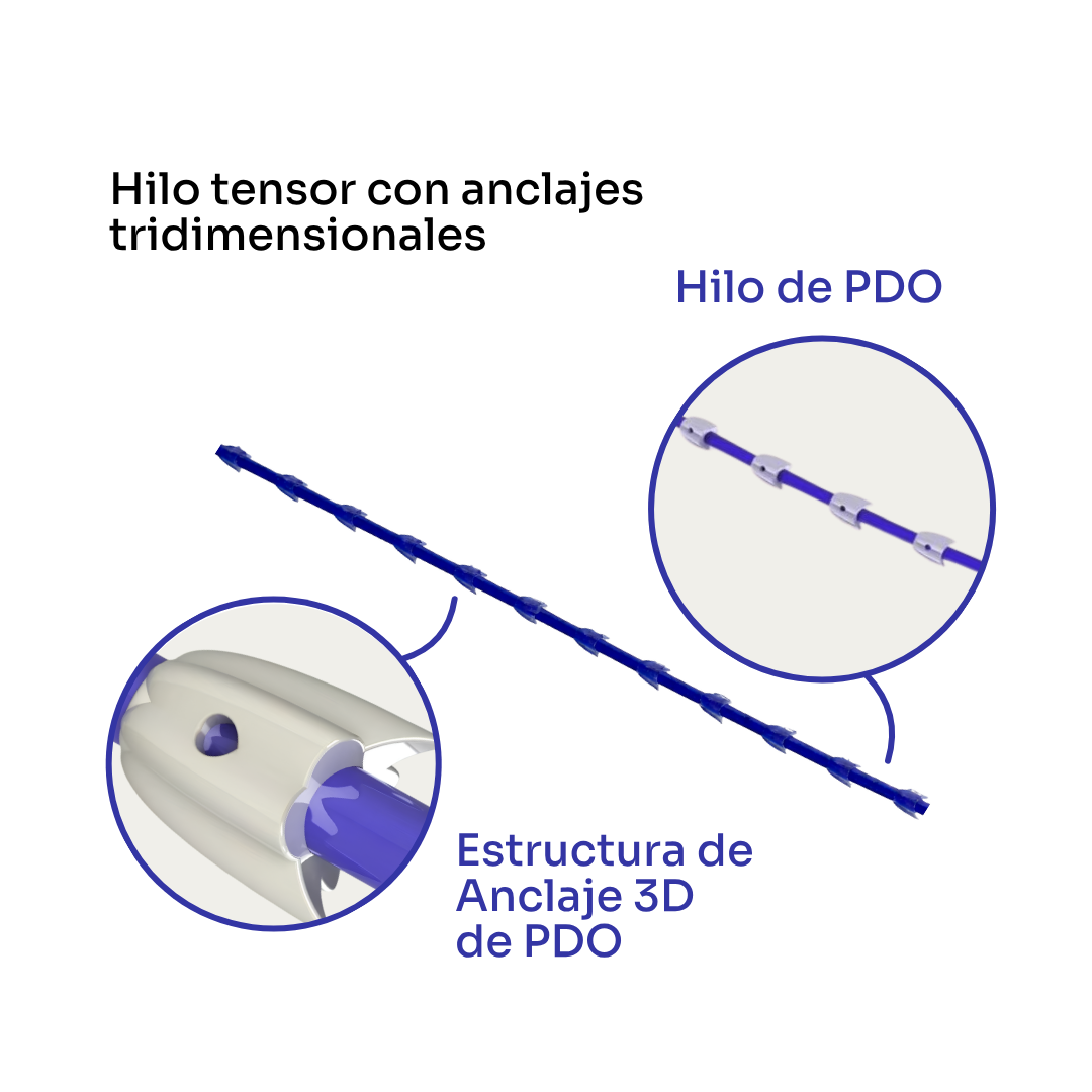 Profesional PDO Anclaje Tridimensional - Detalles